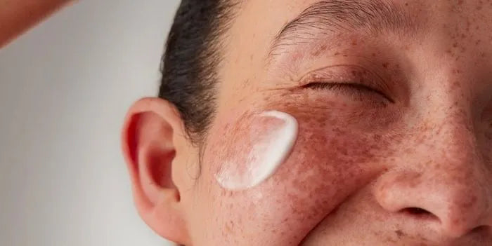 13 Moisturizers for Acne-Prone Skin That Won’t Break You Out