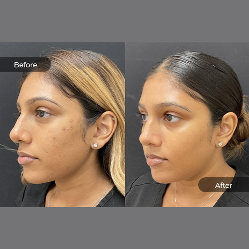 Koji Brightening Pads image 1