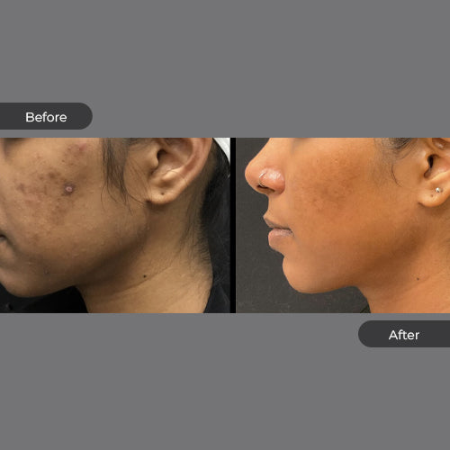 Advanced LUMA Cream image 2