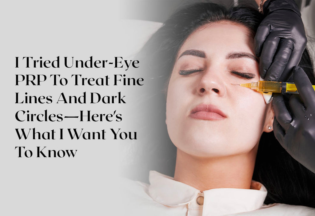 I Tried Under-Eye PRP To Treat Fine Lines And Dark Circles—Here’s What I Want You To Know